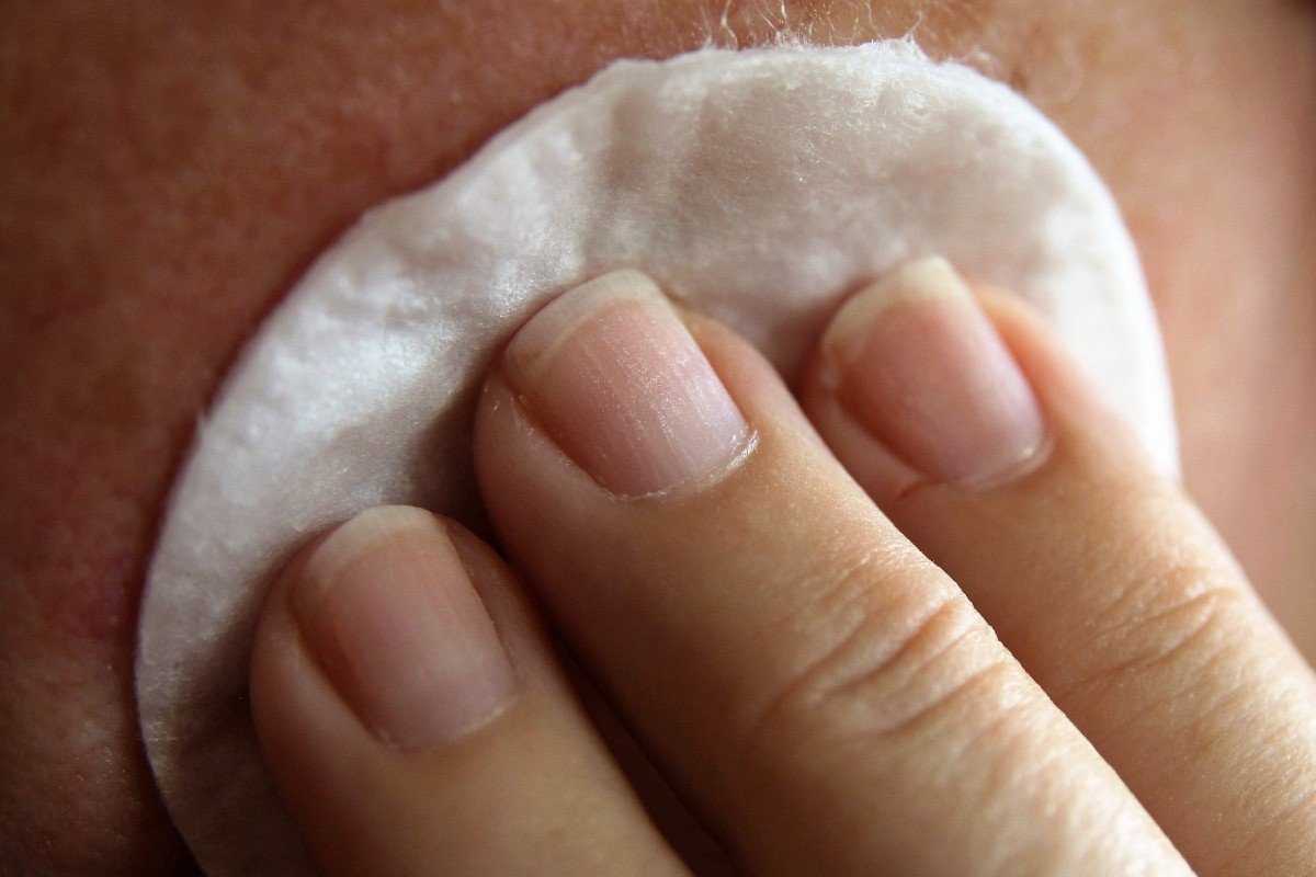 Tips Menggunakan Lotion Anti Nyamuk untuk Kulit sensitif