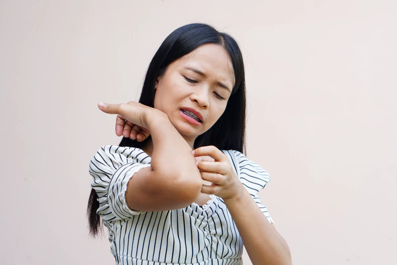 8 Cara Mengatasi Gatal-Gatal pada Kulit Alami