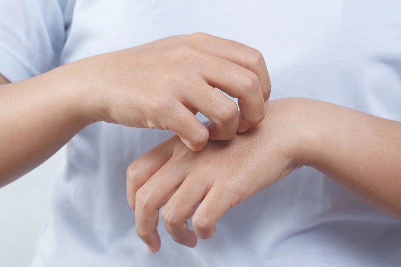10 Cara Menghilangkan Gatal di Badan Secara Alami, Sudah Tahu?