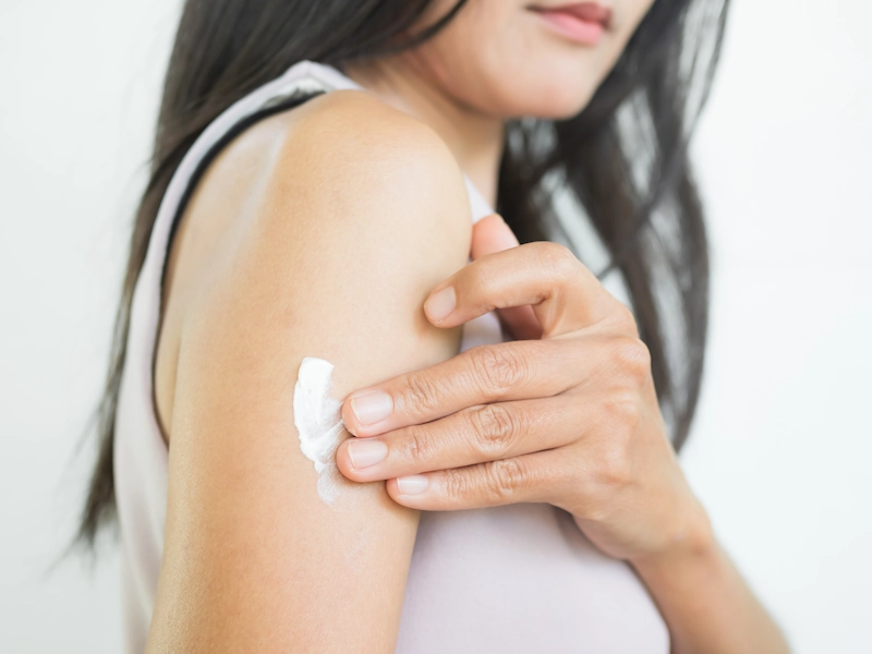 Cara Mengobati Jamur Kulit yang Membandel: 7 Tips