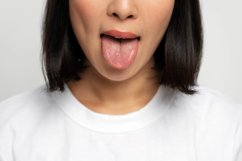 7 Cara Mengembalikan Lidah yang Mati Rasa karena Flu secara Alami