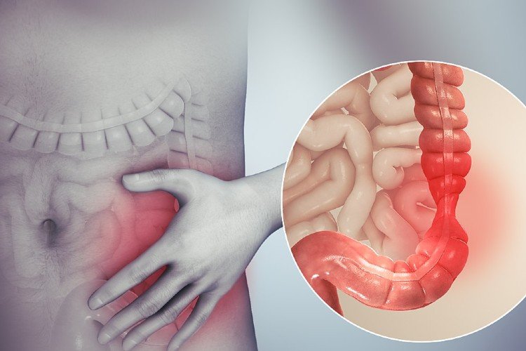 Peran Bakteri Baik dan Serat untuk Usus