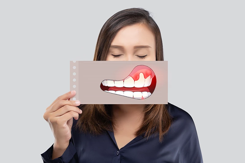 10 Penyebab Gusi Berdarah, Ini Pengobatan & Tips Mencegahnya