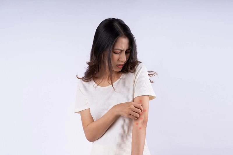 Scabies pada Manusia: Gejala, Penyebab, & Cara Mengobatinya